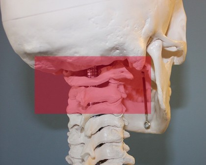 Occiput-atlas-axis focus