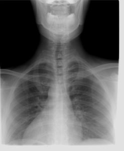 radiographie du cou